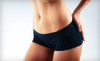 Laser Duet Coupons Dearborn, Michigan Deals