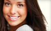 DaVinci - Teeth Whitening Systems Coupons Cocoa, Florida Deals