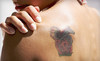 Laser Bella Coupons Tucson, Arizona Deals
