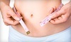 INEVO Contouring Coupons Pittsburgh, Pennsylvania Deals