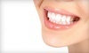 Medplex Dental Coupons Orlando, Florida Deals