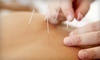 Eastland Acupuncture Coupons Chicago, Illinois Deals