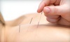 Vitality Acupuncture and Integrative Medicine Coupons Savannah, Georgia Deals